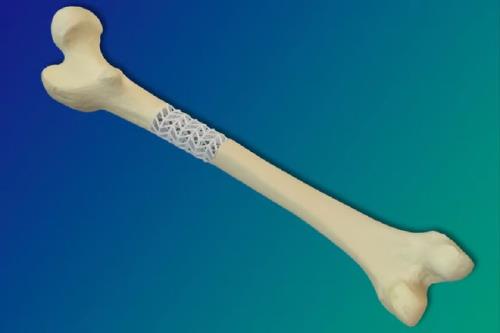 ابداع کامپوزیت جدیدی که می تواند استخوان های شکسته را ترمیم کند