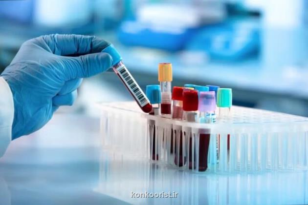 یک آزمایش خون جدید برای تشخیص پارکینسون در مراحل اولیه